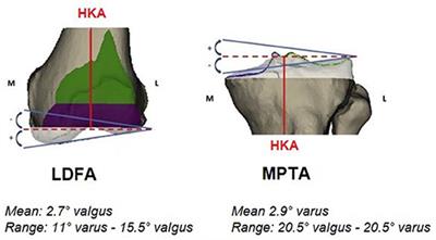 Restricted Kinematic Alignment, the Fundamentals, and Clinical Applications